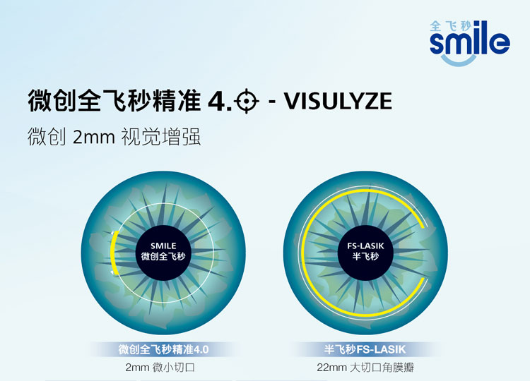 全飞秒精准4.0